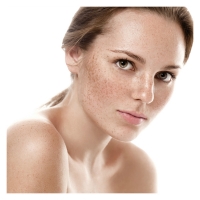 Hidroquinona 99% (Despigmentante)